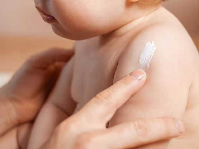 مهمترین راهها برای مقابله با خشکی پوست بچهها